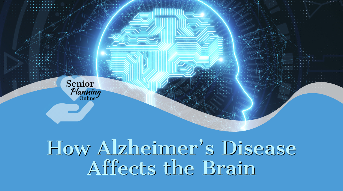 Alzheimers disease affects the brain